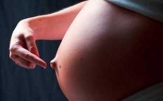 Пупочная грыжа и грыжа белой линии живота у беременных – симптоматика, причины, методы лечения