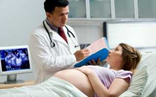 Санатории для беременных: как получить бесплатно путёвку