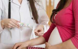Белок в моче при беременности – что это значит и как лечить