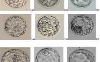 Классификация эмбрионов: оценка качества эмбрионов в программах ЭКО