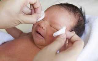 Проблемы с глазами у новорожденных и их решение