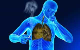 Симптомы и лечение кашля курильщика